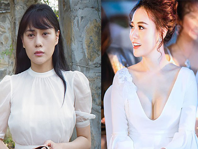 Thẩm mỹ viện - "Quỳnh Búp bê" giải thích về gương mặt bất ngờ khác lạ