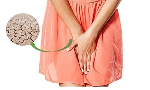 Slady đẩy lùi khô hạn, níu chặt bạn đời - 1