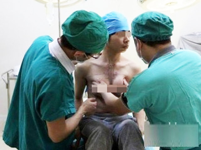 Người mẫu - Hoa hậu - Phẫu thuật chuyển giới: Nỗi đau và rủi ro kinh hoàng mấy ai thấu?