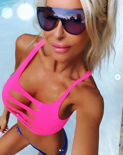 “Tiên cá” U50 mê phẫu thuật thẩm mỹ bất chấp nguy hiểm - 1