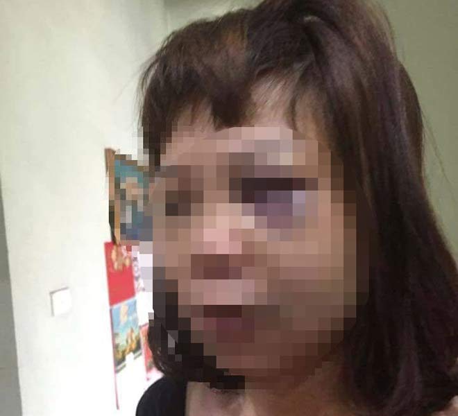 Tin mới nhất vụ chồng đưa vợ lên đồi vắng bạo hành dã man - 1