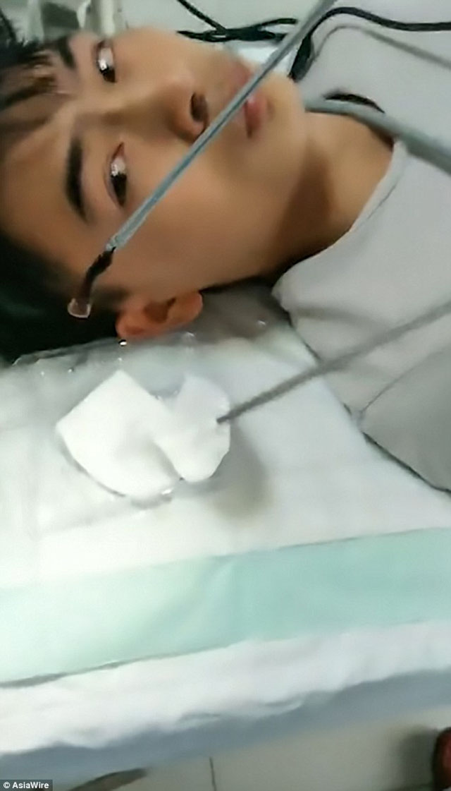 TQ: Phát hiện đỉa làm tổ trong mũi nam thanh niên - 1