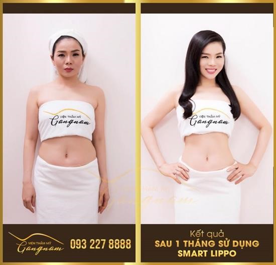 Giảm béo Smart Lipo: bước đột phá được công nhận bởi tổ chức uy tín thế giới - 3
