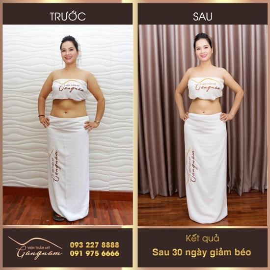 Giảm béo Smart Lipo: bước đột phá được công nhận bởi tổ chức uy tín thế giới - 4