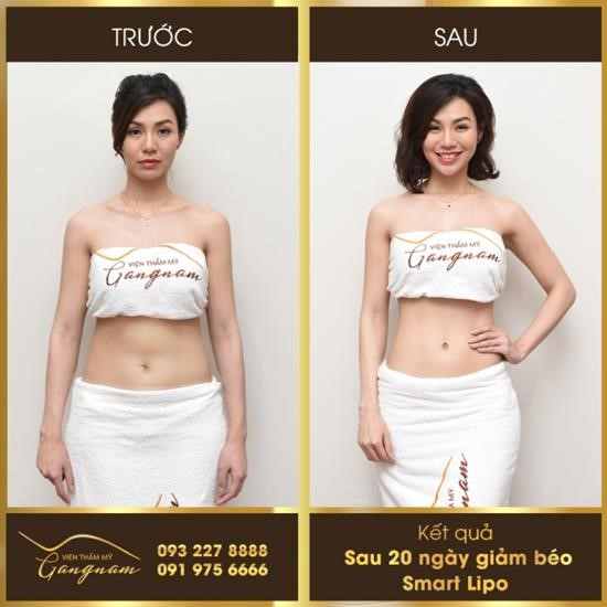 Giảm béo Smart Lipo: bước đột phá được công nhận bởi tổ chức uy tín thế giới - 5