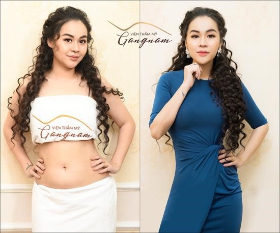 Giảm béo Smart Lipo: bước đột phá được công nhận bởi tổ chức uy tín thế giới - 7