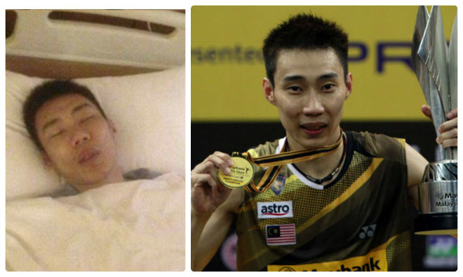 Chấn động cầu lông: Huyền thoại Lee Chong Wei ung thư, fan bàng hoàng - 1