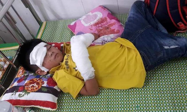 Điện thoại phát nổ, bé 7 tuổi dập nát bàn tay​​​​​​​ - 1