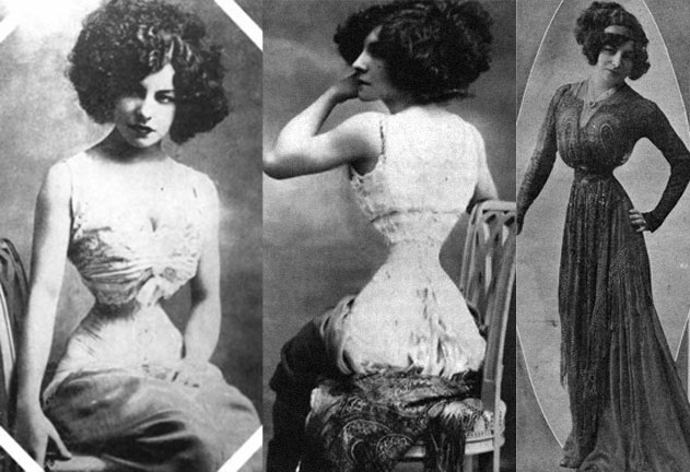 Lý do người đàn bà Pháp có eo nhỏ 40cm bị chê xấu nhất thế giới - 1