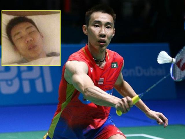 Huyền thoại cầu lông Lee Chong Wei bị ung thư: Hãy chuẩn bị điều tệ nhất