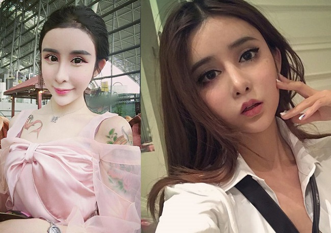 Cô gái Trung Quốc sinh năm 1999 - Lý Ân Hy vốn sở hữu ngoại hình xinh xắn, đáng yêu. Nhưng vì quá thích gương mặt V-line đạt chuẩn mà cô đã quyết phẫu thuật thẩm mỹ, dẫn đến hủy hoại nhan sắc khi mới 15 tuổi.