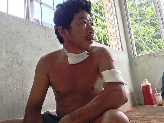 Vụ cắt cổ cha bạn gái: Kinh hoàng lời kể của nạn nhân - 3