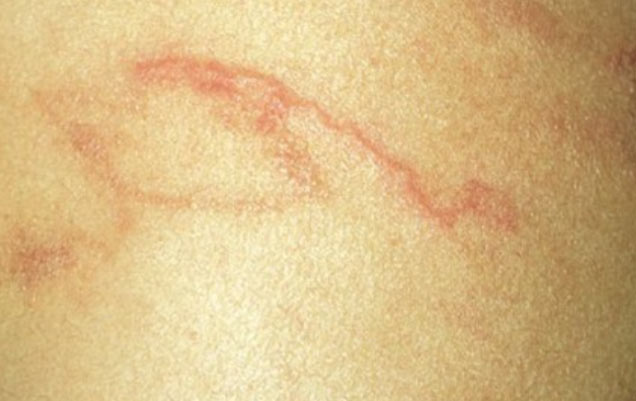 Chỉ chăm hoa mỗi ngày, một phụ nữ hoảng hồn khi ho ra sinh vật nhỏ xíu - 1