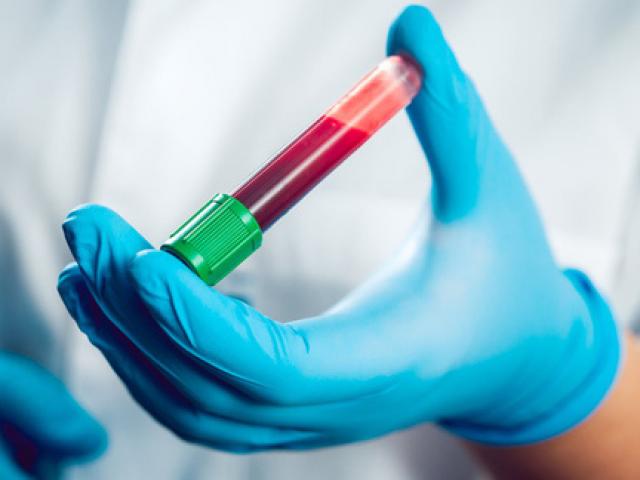 Sức khỏe đời sống - Người đầu tiên trên thế giới nhiễm viêm gan siêu vi E lạ lùng