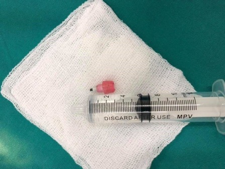 Vừa được đưa đến viện bé 6 tuổi lập tức ngưng tim, ngưng thở vì nguyên nhân này - 1