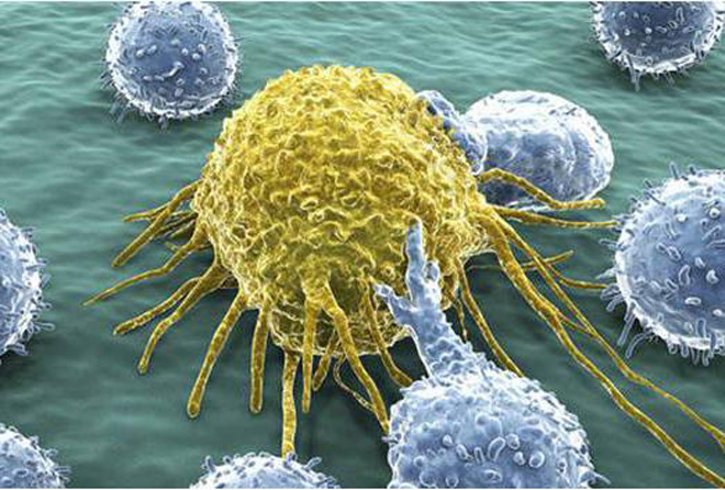 Tại sao u bướu lại hình thành? Làm thế nào để ngăn chặn khối u tiến triển thành ung thư? - 1