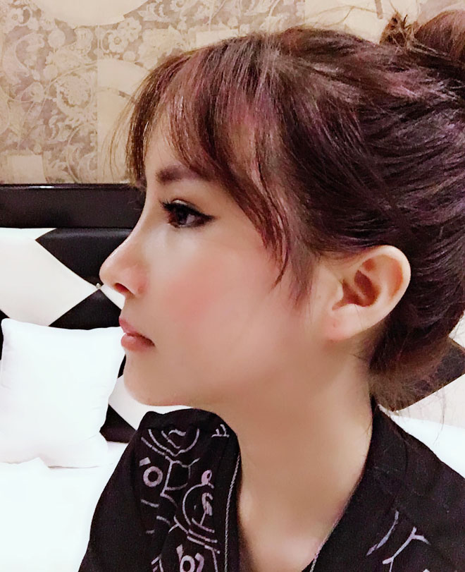 Sự thay đổi khó tin của cô gái từng bị bạn chế nhạo chỉ nên yêu người răng hô - 6