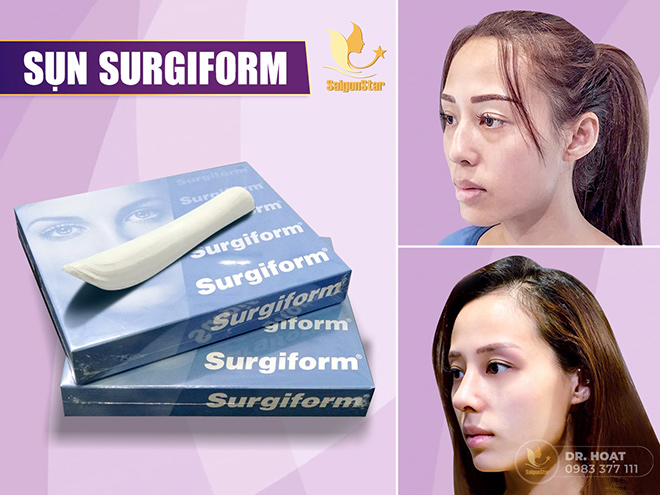 Bác sĩ nổi tiếng Sài Gòn chuyên “giải cứu” những ca thẩm mỹ mũi hỏng - 3