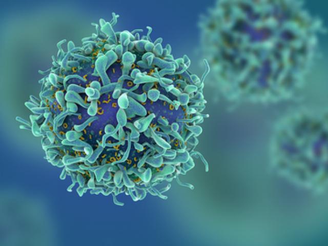 Sức khỏe đời sống - Nghiện những món này, người Việt tự rước căn bệnh ung thư khó phát hiện nhất