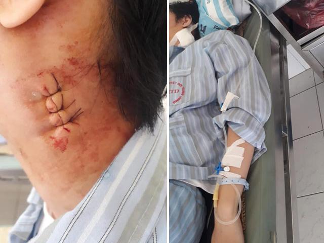 Tin tức trong ngày - BV Nhiệt đới Trung ương, BV Bạch Mai bị tố chẩn đoán sai, mổ nhầm cho bé trai