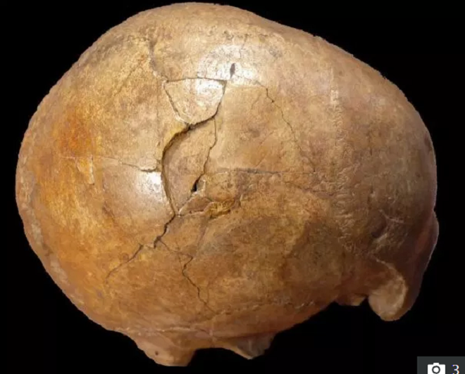 Romania: Hộp sọ 33.000 năm tuổi bị nứt vỡ hé lộ câu chuyện đáng sợ - 1