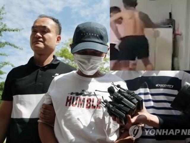 Thế giới - Chồng Hàn đánh vợ Việt gãy xương: Câu nói bất ngờ của người chồng