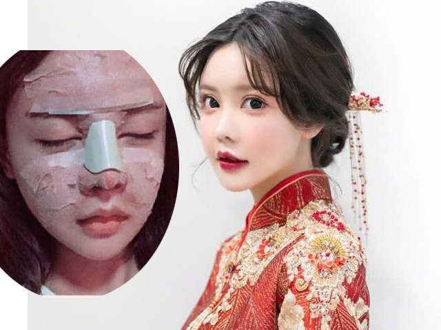 Làm đẹp - Cô gái Trung Quốc 20 tuổi phẫu thuật thẩm mỹ tổng cộng 33 lần