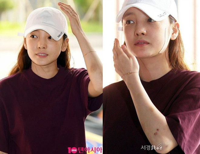 Cưới nhau sau 12 ngày, nữ diễn viên Hàn bị chồng đạp vào bụng sảy thai - 1