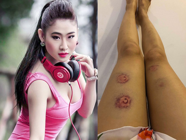 Giải trí - Lý do DJ miền Tây gợi cảm bầm dập đầy người sau thời gian "mất tích"