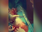 Tin tức trong ngày - Đốn tim với khoảnh khắc em bé chào đời trong bọc ối, chớp mắt mỉm cười