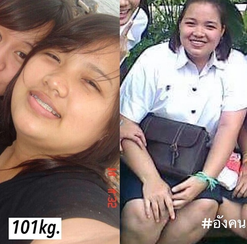 Từng nặng hơn 100kg khiến cô nàng tên Ang vô cùng khổ sở