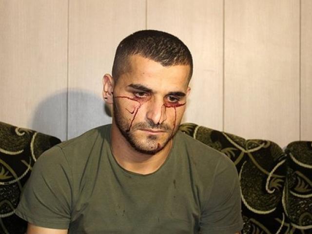 Phi thường - kỳ quặc - Người đàn ông bị máu chảy ra không ngừng từ mắt và tai