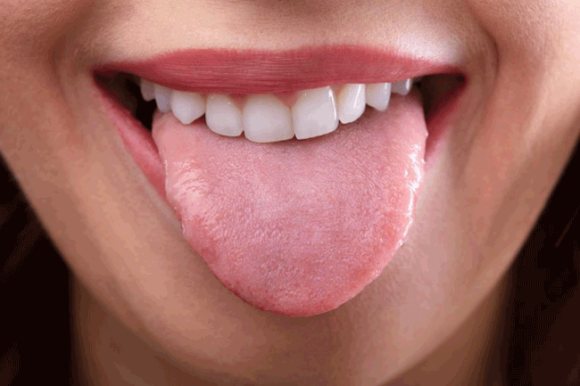 3. Thè lưỡi: Nhẹ nhàng thè lưỡi để ngăn chặn tiếng nấc. Thè lưỡi giúp kích thích dây thần kinh phế vị và giảm co thắt cơ hoành.
