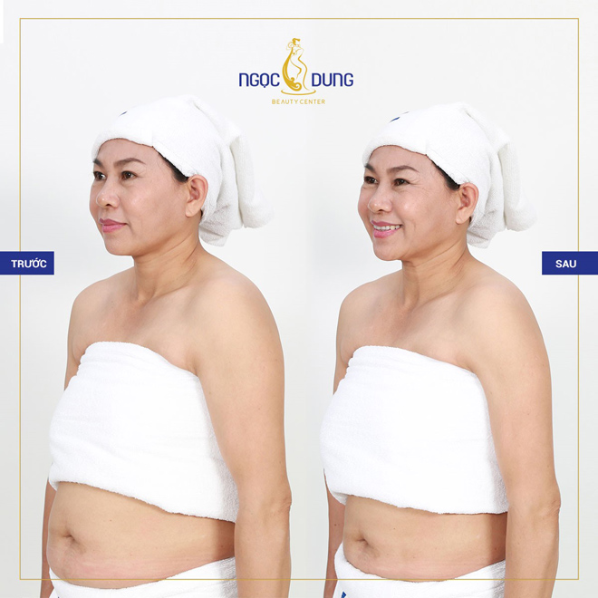 Khách hàng đã giảm béo thành công tại TMV Ngọc Dung