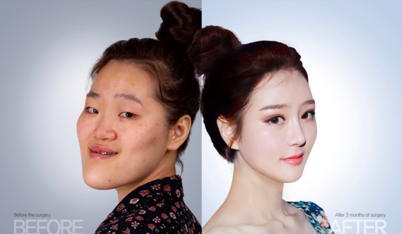 Hàn Quốc: Xấu xí là thất bại đời người đến hiện tượng "100 khuôn mặt trông như 1" - 1