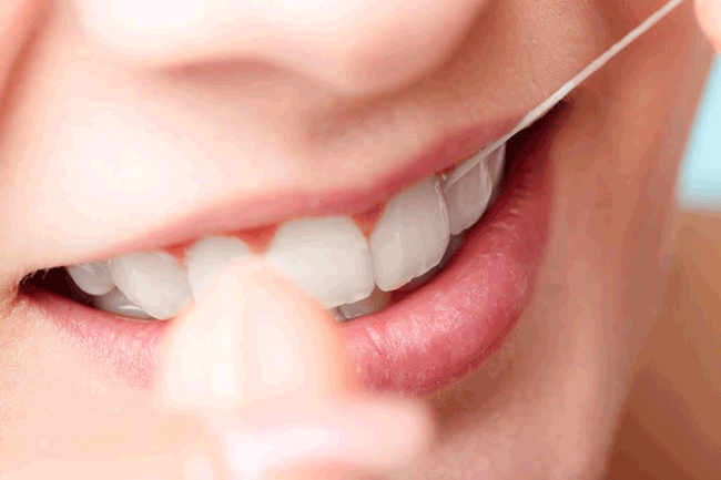 4. Không đánh răng hoặc dùng chỉ nha khoa đều đặn: Răng nhiều mảng bám sẽ có nhiều nguy cơ, bao gồm sâu răng, viêm nướu, nhiễm trùng nặng, bệnh tim mạch, suy dinh dưỡng, đặc biệt là ở người già. Đánh răng 2 lần mỗi ngày, dùng chỉ nha khoa mỗi ngày 1 lần và gặp nha sĩ thường xuyên để tránh điều này.