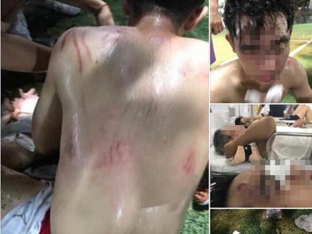 Pháp luật - Thực hư chuyện giao hữu bóng đá với đối thủ bắt qua mạng, cả đội bị đánh nhập viện