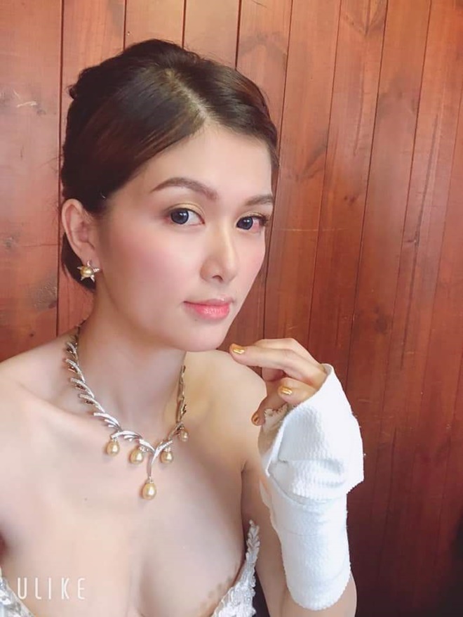 &nbsp;Đặc biệt, cô đeo bộ trang sức hơn 1 tỷ được thiết kế tinh xảo. Trước khi buổi tiếc diễn ra, Oanh Yến chia sẻ việc gặp sự cố gãy tay và đau mắt. Cô hy vọng quan khách sẽ thông cảm cho cô nếu có sơ sót trong quá trình tổ chức, đón tiếp.&nbsp;Do thời gian gấp gáp nên người đẹp rất tiếc vì còn thiếu sót, chưa mời đủ những gương mặt thân quen để bày tỏ lòng tri ân