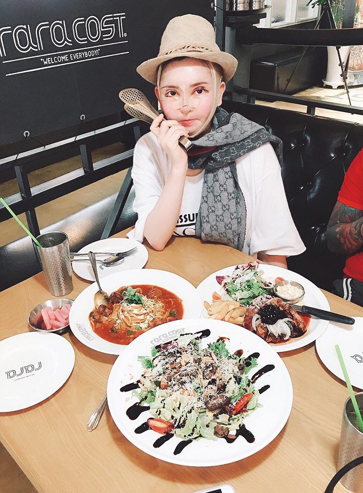 Vân Tokyo tự tin xuất hiện với gương mặt băng bó