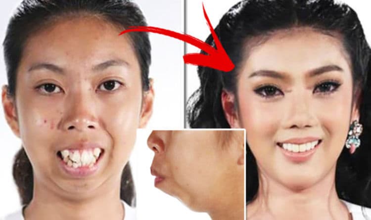 Ngoại hình của&nbsp;Wijitpraphorn Punbu thay đổi sau khi tham gia chương trình Let Me In bản Thái