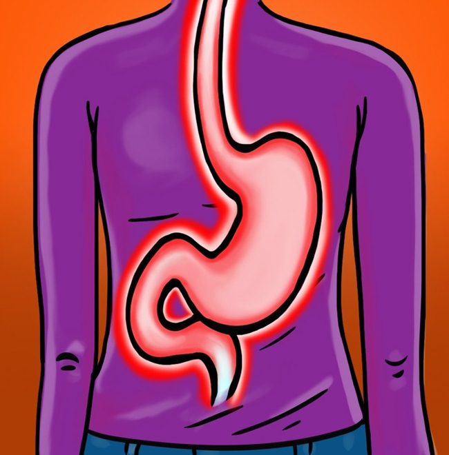 Ai ngờ lo lắng, căng thẳng lại gây nhiều bệnh nguy hiểm đến vậy - 4