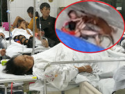 Tin tức trong ngày - Cụ bà nói về lý do bị chó nhà cháu ngoại cắn bê bết máu