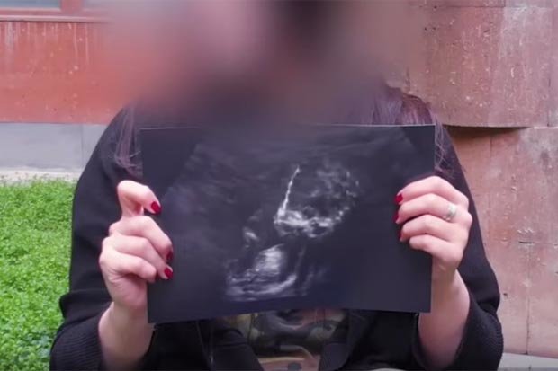 Người phụ nữ đưa ra hình ảnh siêu âm về đứa con lai giữa cô và "người ngoài hành tinh"