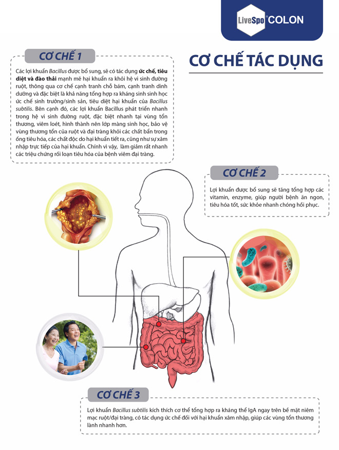 Cơ chế xử lý viêm đại tràng của Bào tử lợi khuẩn LiveSpo Colon
