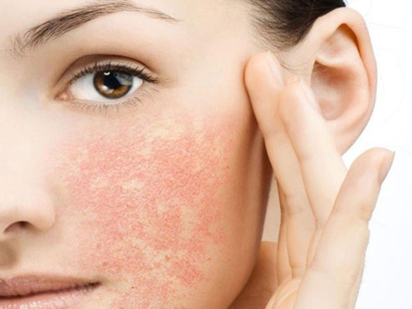Muốn có làn da trẻ đẹp, đừng quên 5 quy tắc skincare cơ bản sau - 3