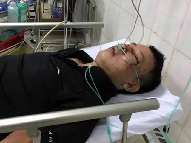 Pháp luật - Đi hát karaoke bị chủ quán cùng nhân viên đánh hội đồng