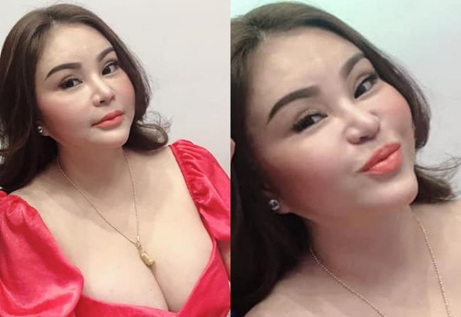 Mới đây, trên trang cá nhân, danh hài tiếp tục khoe ảnh cận mặt với cằm thon gọn, môi căng mọng tạo nên diện mạo đơ cứng như tượng sáp... khiến người hâm mộ lo lắng cô sẽ nhận lại biến chứng của phẫu thuật thẩm mỹ.