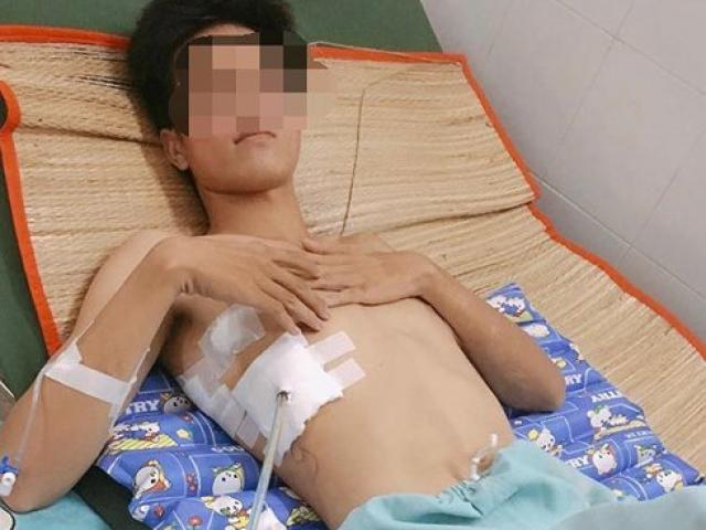 Sức khỏe đời sống - Thanh niên 23 tuổi “chết đi sống lại” xin các bạn trẻ hãy bỏ thuốc