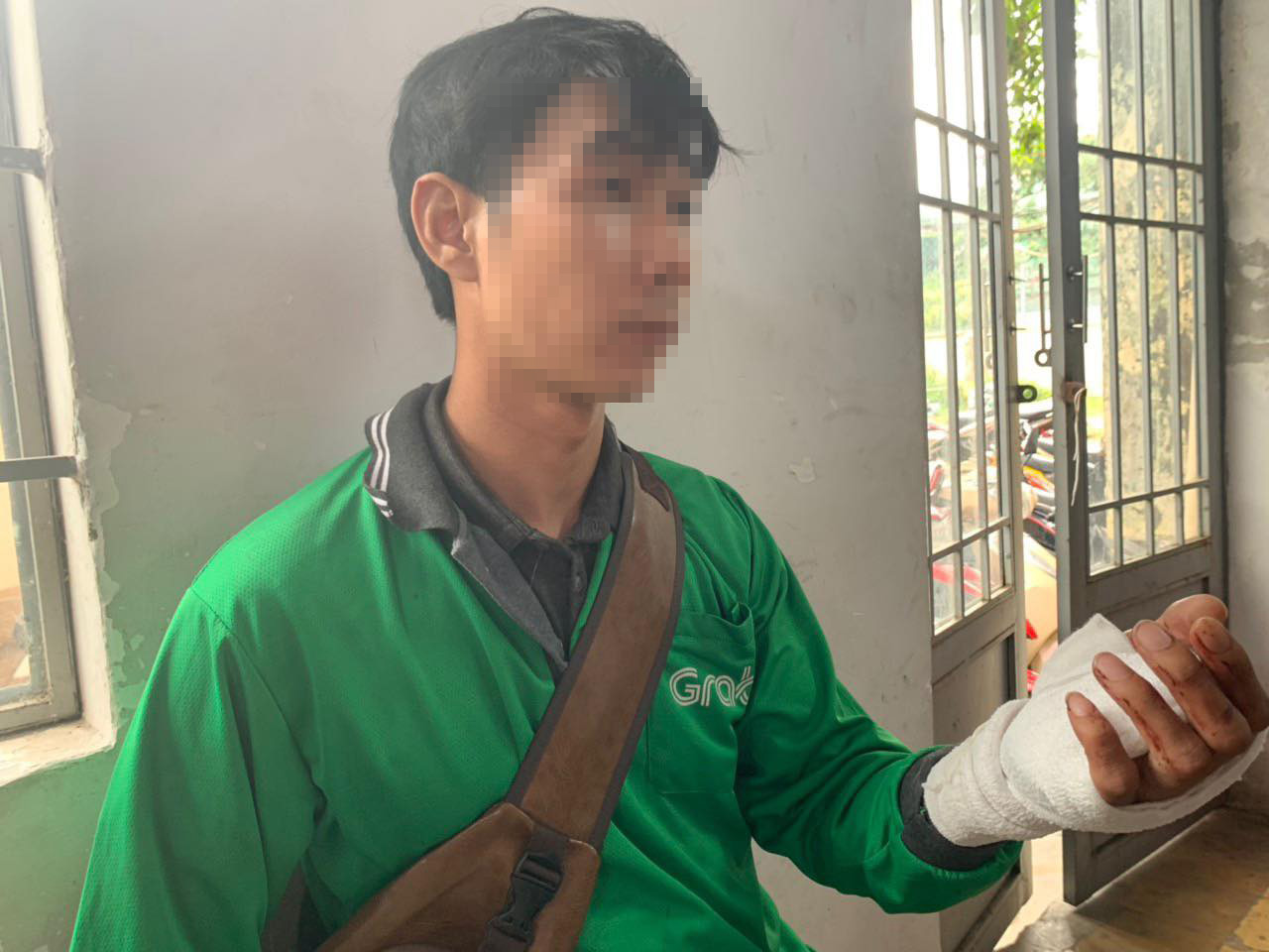 Nạn nhân anh H.T.H. bị thương ở tay sau khi giằng co, tước dao tên cướp