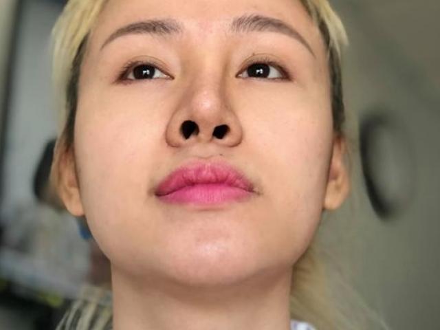 Làm đẹp - Từng chi hơn 100 triệu để làm mũi, Bà Tưng "đắng lòng" nhận hậu quả